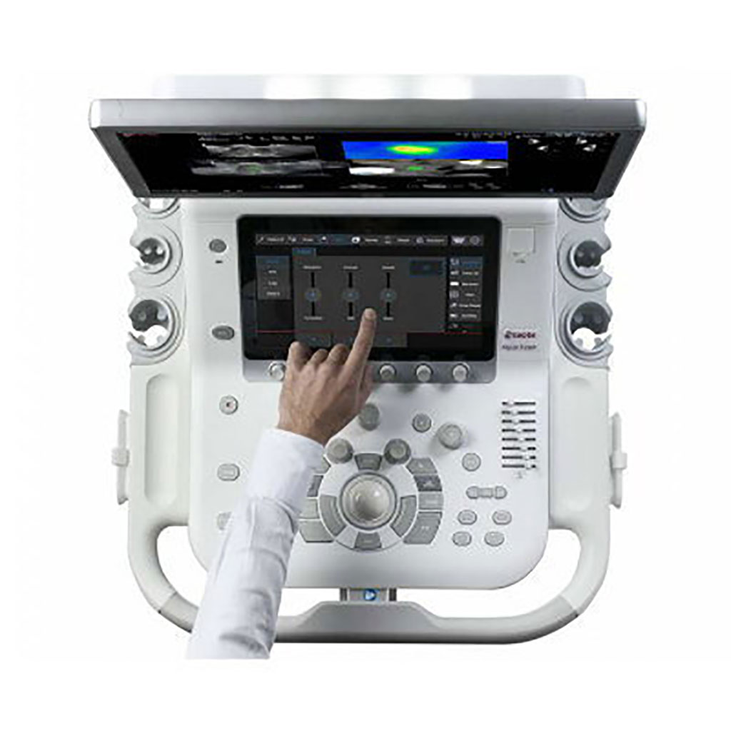 Image: The MyLab X8 Ultrasound System (Photo courtesy of Esaote) Image: The MyLab X8 Ultrasound System (Photo courtesy of Esaote)