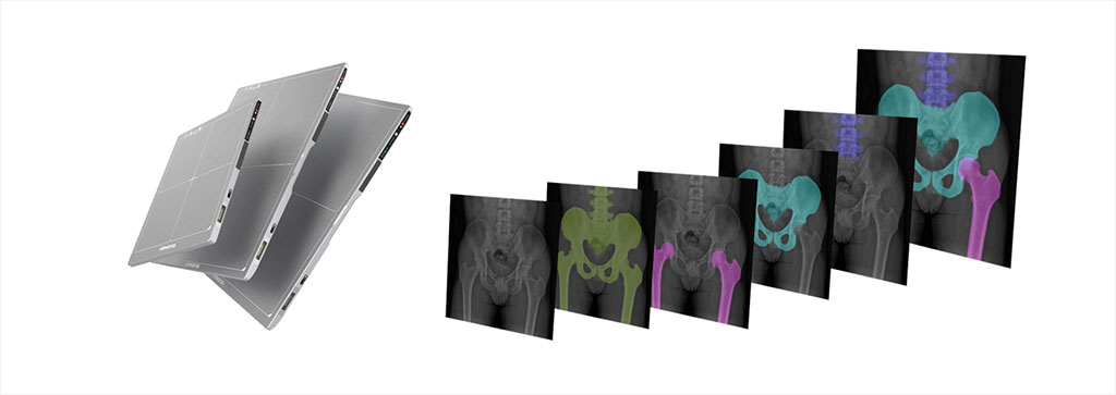 Image: Next Generation Photon-Understanding Detector Solution (Photo courtesy of Vieworks Co., Ltd.)