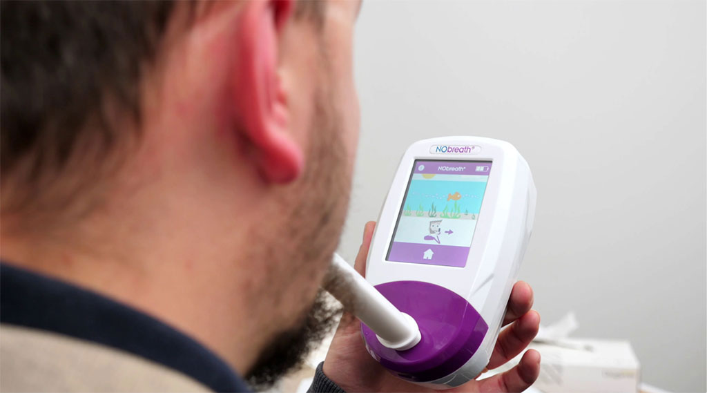Image: The NObreath FeNO monitor measures airway inflammation (Photo courtesy of Bedfont Scientific)