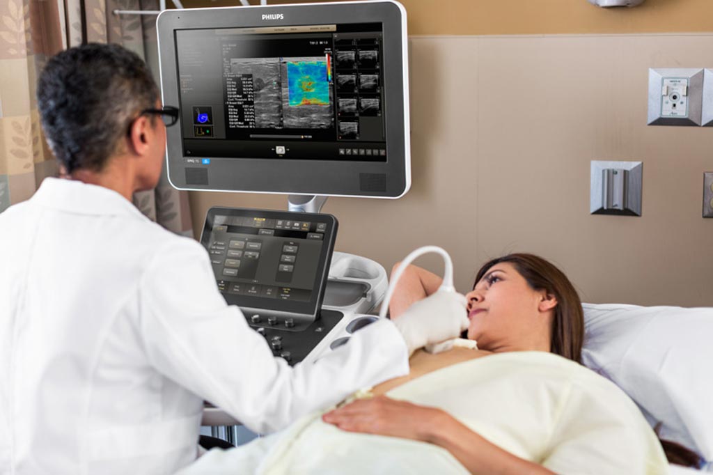 Image: Siemens Reportedly Considering Sale of Its Ultrasound Business (Photo courtesy of Philips Healthcare)
