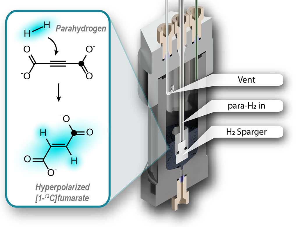 Image: Hyperpolarization of fumarate for use as a biosensor (Photo courtesy of John Blanchard, James Eills) Image: Hyperpolarization of fumarate for use as a biosensor (Photo courtesy of John Blanchard, James Eills)