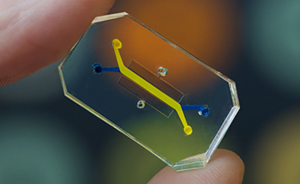 Image: Organ-on-a-Chip Technology Rapidly Repurposes Existing Drugs for Treatment of COVID-19 (Photo courtesy of Wyss Institute)