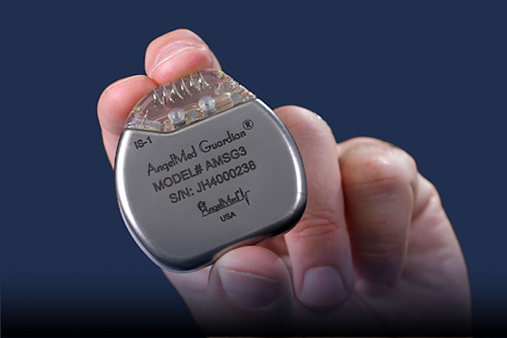Image: The AngelMed Guardian implantable cardiac detection monitor (Photo courtesy of AngelMed)