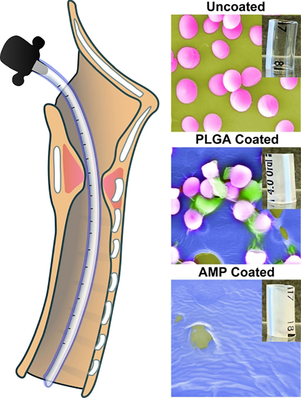 Image: Electron microscopy images of coated and uncoated ET tubes (Photo courtesy of CHOP)