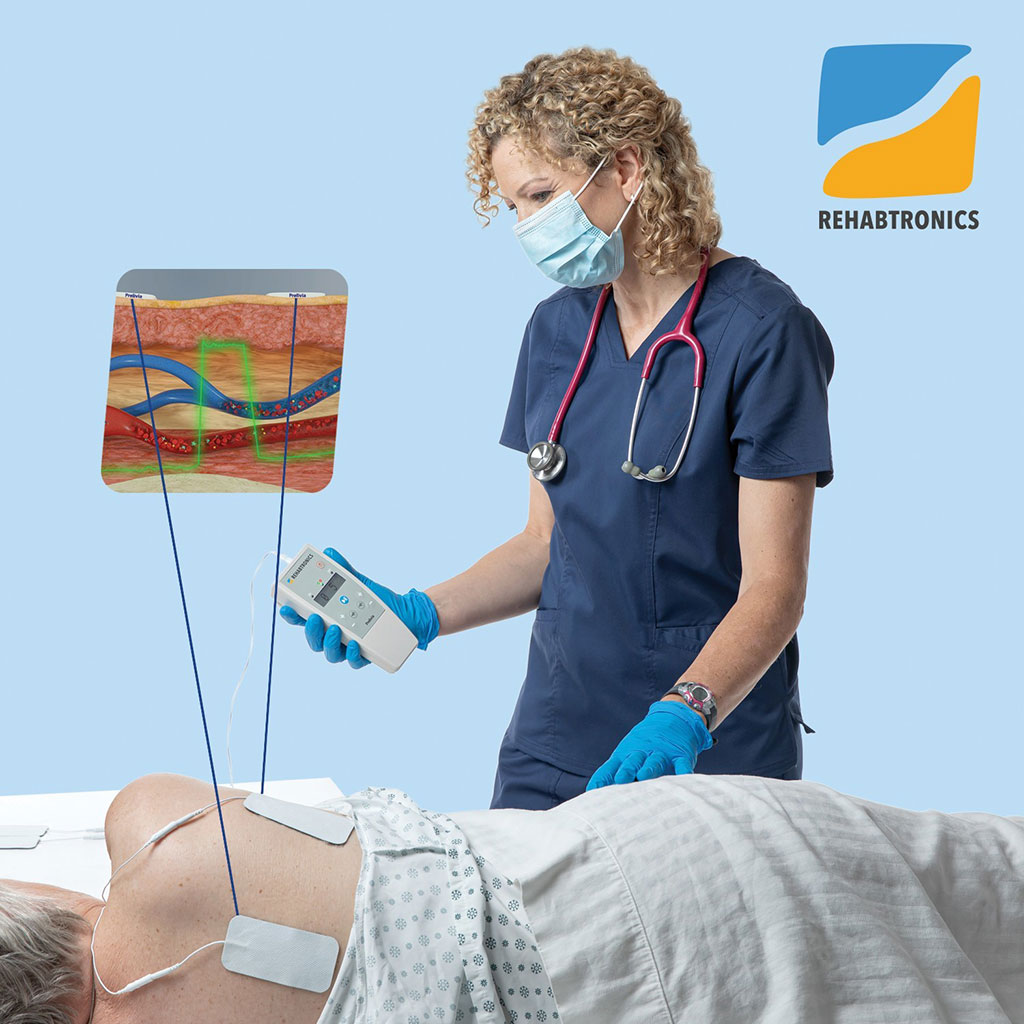 Image: The Prelivia neurostimulator protects patient from pressure injuries. (Photo courtesy of Rehabtronics)