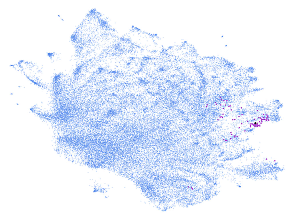 Phe2vec identified dementia cases (purple dots) from a two million patient database (blue dots) (Photo courtesy of MSSM)