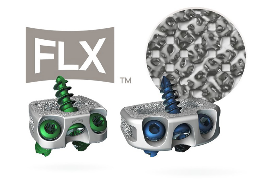 Image: The STALIF C FLX and STALIF M FLX 3D-printed interbody devices (Photo courtesy of Centinel Spine)