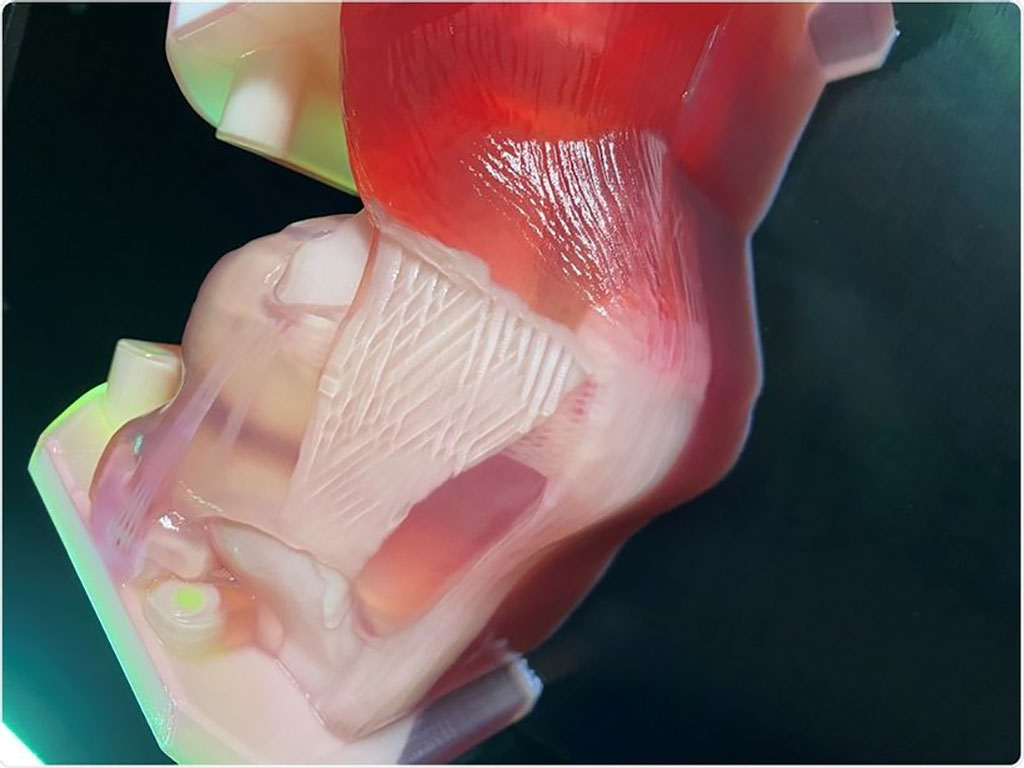 Image: A Fusetec 3D anatomical model (Photo courtesy of Fusetec)