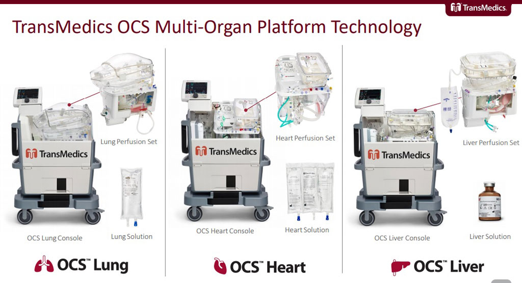 Image: The TransMedics Organ Care System (OCS) (Photo courtesy of Transmedics)