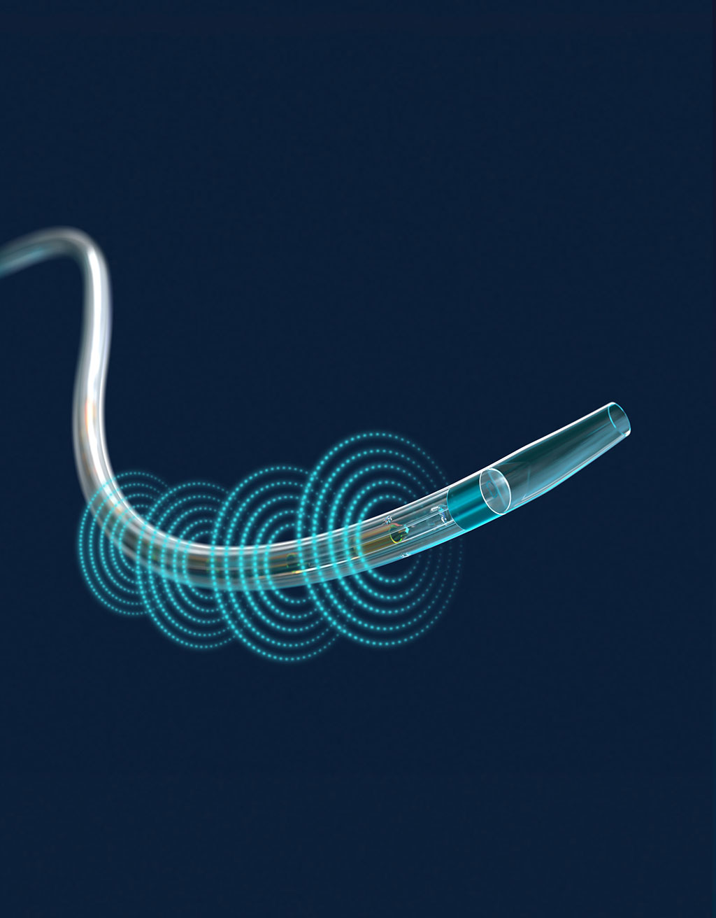 Image: The EkoSonic IDDC and removable coaxial ultrasound transducer core (Photo courtesy of  EKOS Corporation)