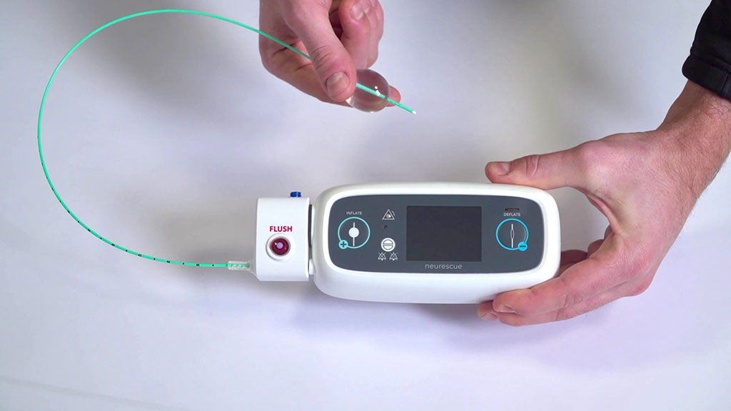 Image: The NeuRescue occlusion catheter and control unit (Photo courtesy of NeuRescue)