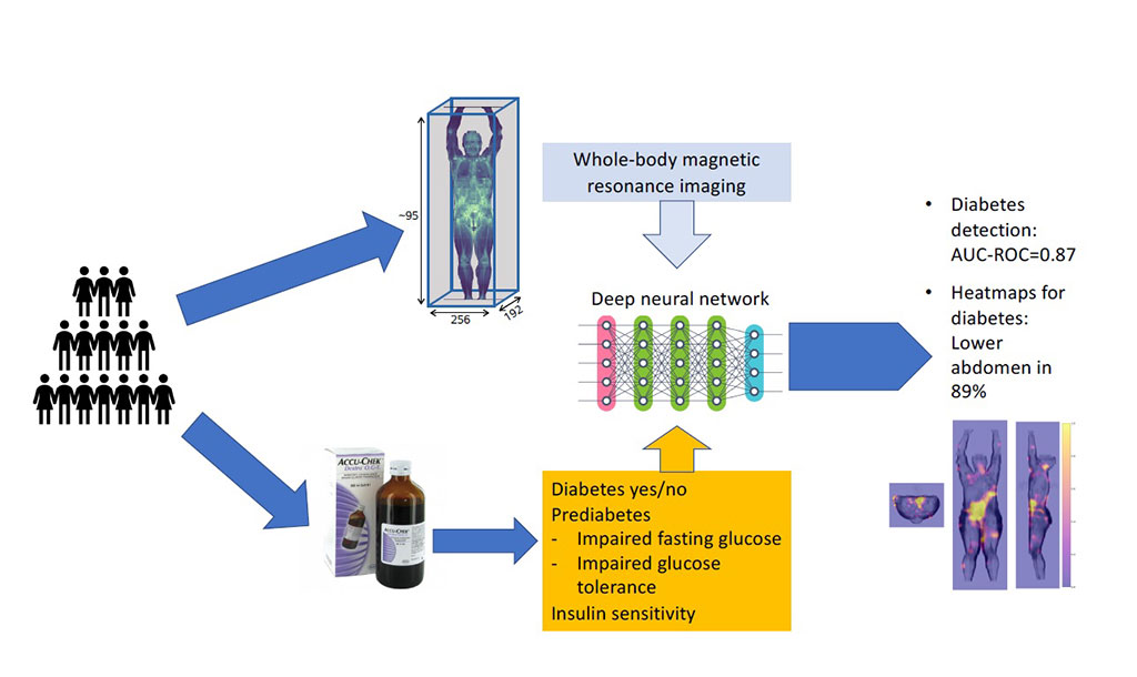 Image: Diabetes detection from whole-body MRI with deep learning (Photo courtesy of DZD, JCI Insight.) Image: Diabetes detection from whole-body MRI with deep learning (Photo courtesy of DZD, JCI Insight.)