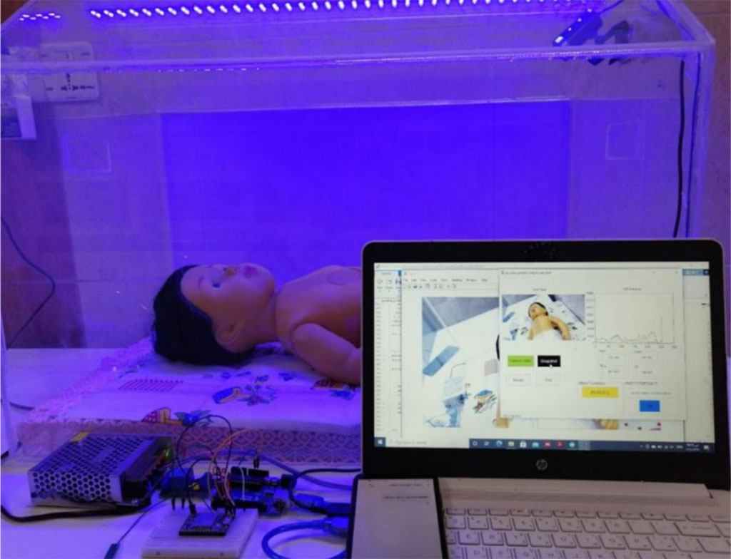 Image: An automated imaging system help treat neonatal jaundice (Photo courtesy of UNISA)
