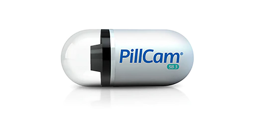Image: The PillCam SB3 @HOME (Photo courtesy of Medtronic)