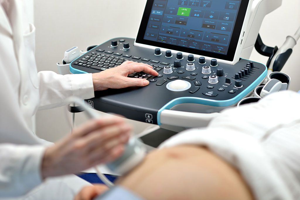 Image: The Resona 7 Lightning Edition cart-based ultrasound device (Photo courtesy of Mindray) Image: The Resona 7 Lightning Edition cart-based ultrasound device (Photo courtesy of Mindray)