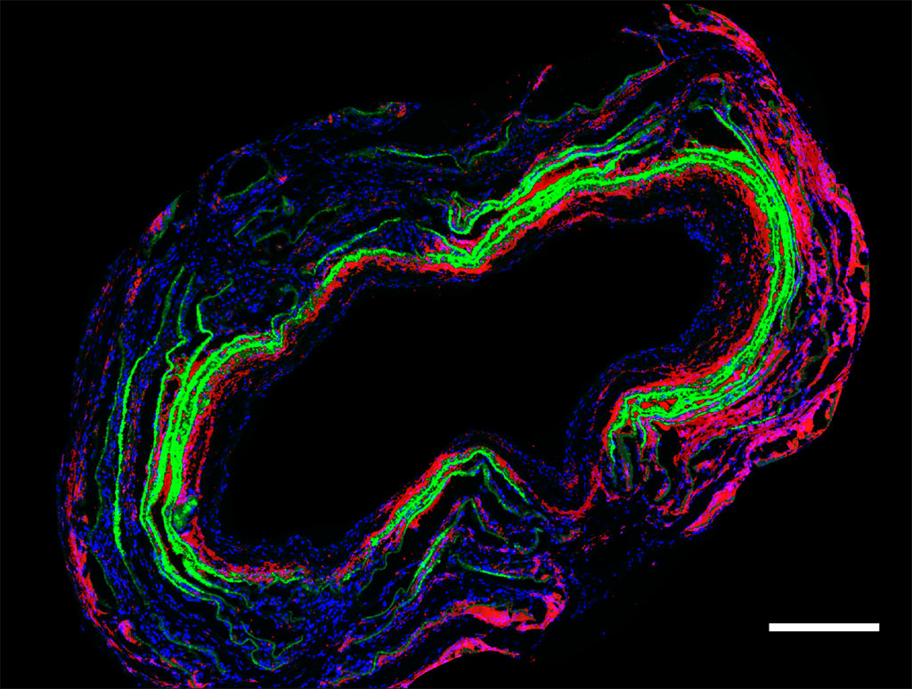 Image: Cross-section of tissue-engineered vascular graft (Photo courtesy of Swanson School of Engineering)