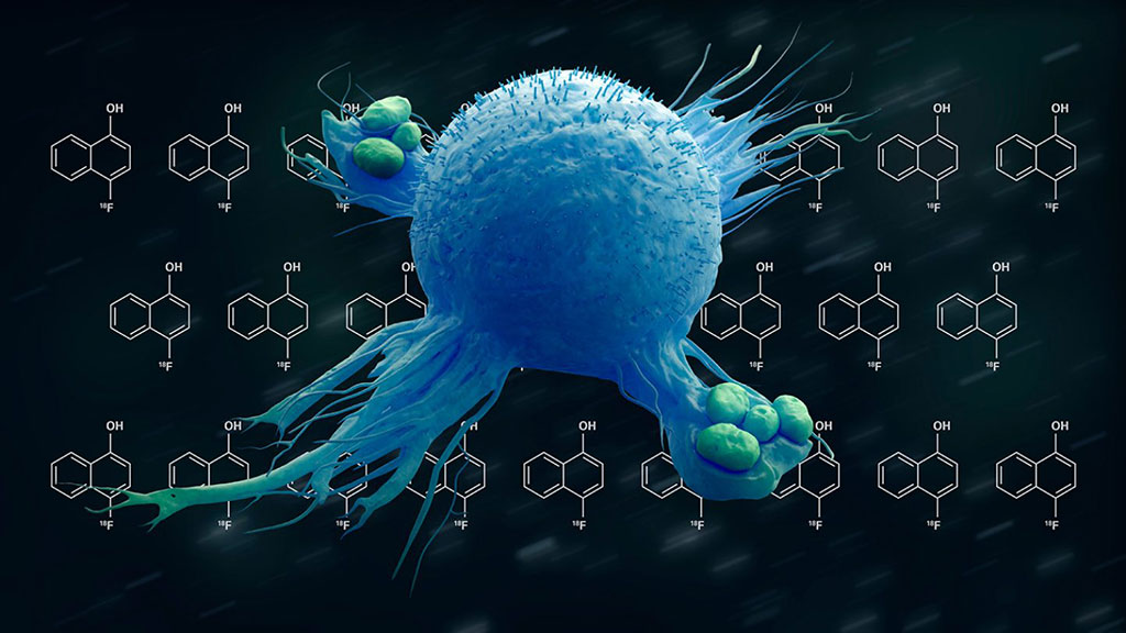 Image: New molecule offers improved specificity to monitor inflammation (Photo courtesy of The University of Texas MD Anderson Cancer Center)
