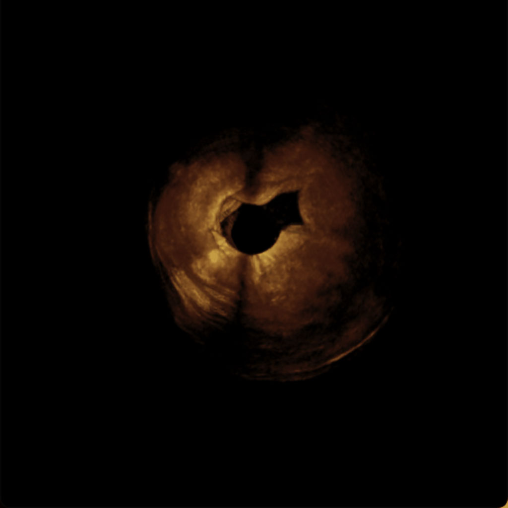 Image: 3D reconstruction of a rabbit uterus in OCT (Photo courtesy of The University of Manchester)