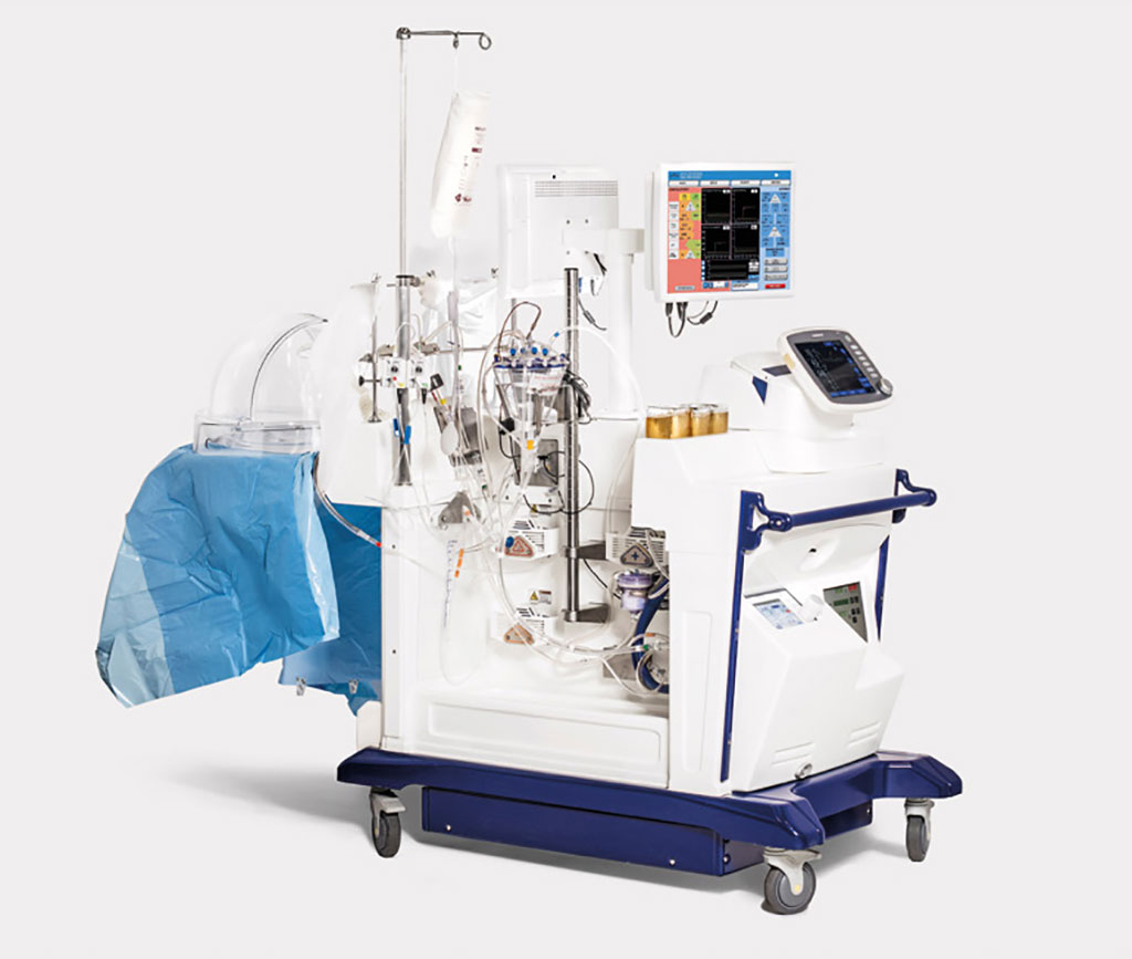 Image: The XPS is CE-marked and FDA approved for ex vivo lung perfusion of initially unacceptable donated lungs (Photo courtesy of XVIVO)