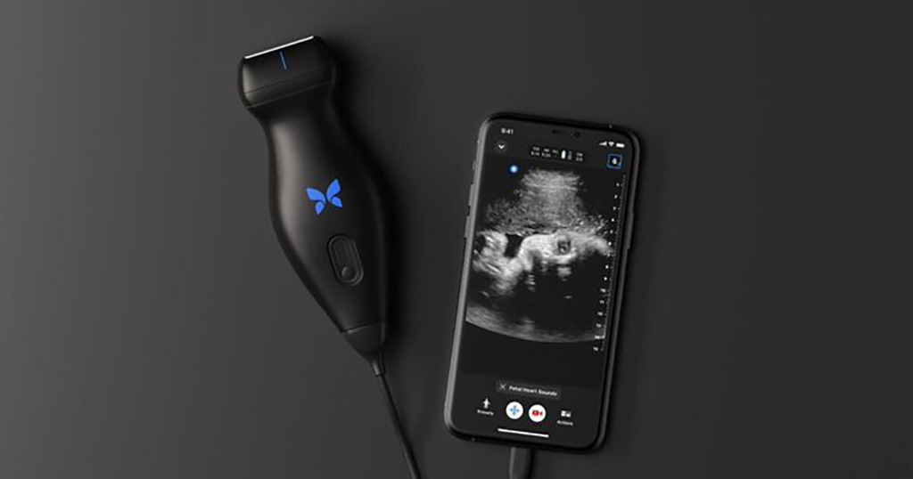 Image: Landmark study empowers nurse midwives to perform at level of trained sonographers using Butterfly (Photo courtesy of Butterfly Network, Inc.)