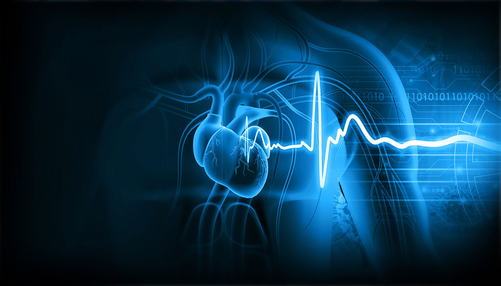 Image: A new collaboration will focus on developing software for earlier detection of CVD (Photo courtesy of Anumana)