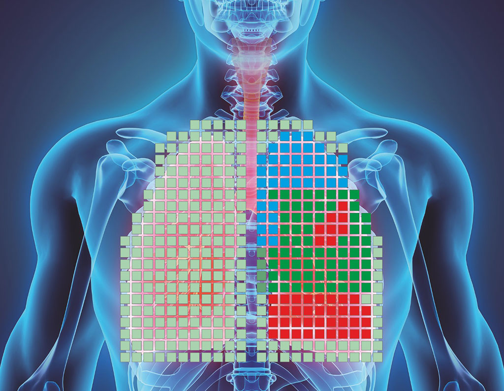 Image: Visual representation shows different lung areas and their ventilation situation (Photo courtesy of Fraunhofer IKTS)
