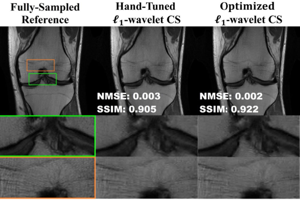 Image: New research closes the gap between traditional and deep learning methods (Photo courtesy of University of Minnesota)