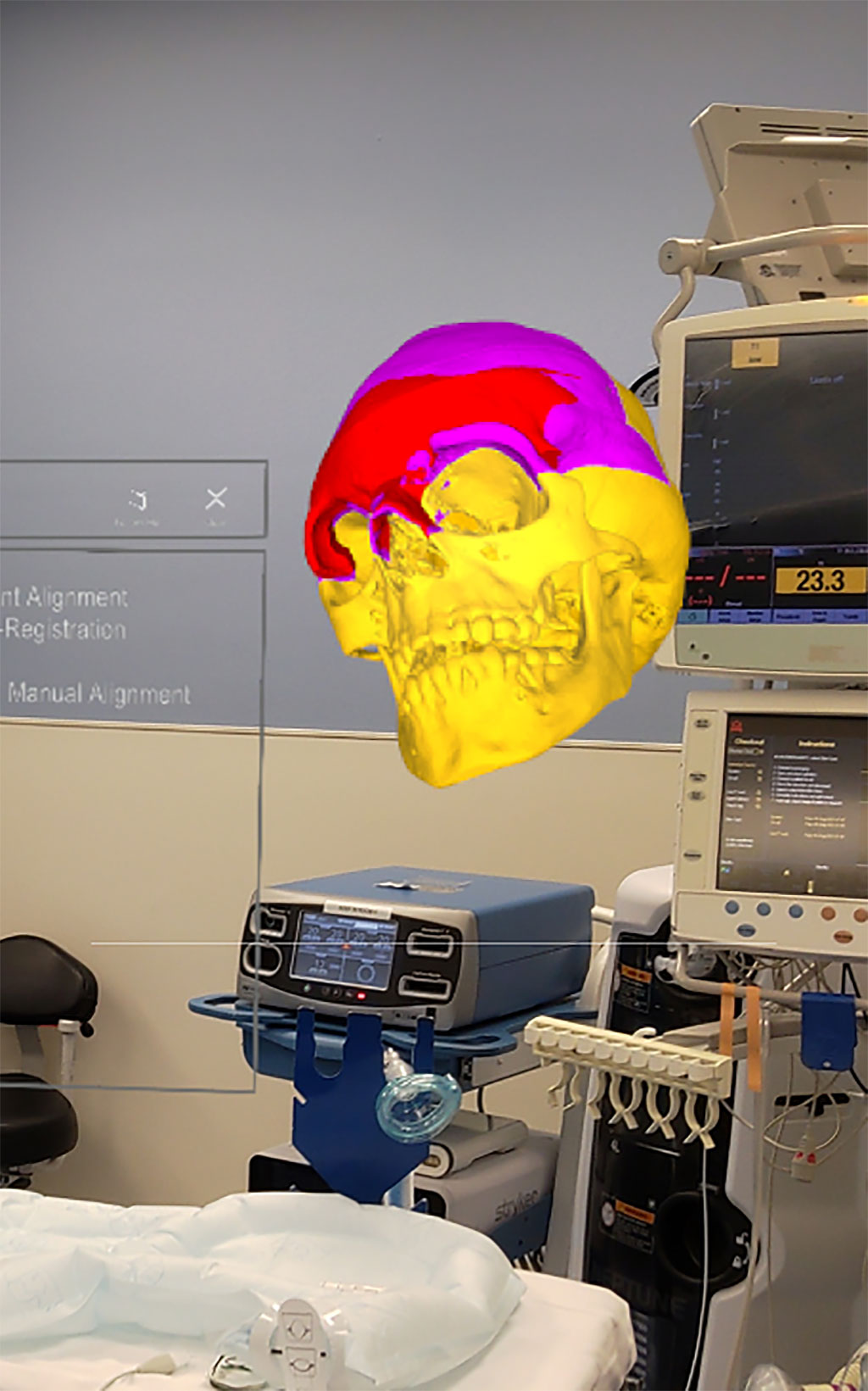 Image: IntraOpVSP displays segmented 3D holograms originally acquired from CT and MRI (Photo courtesy of Xironetic)