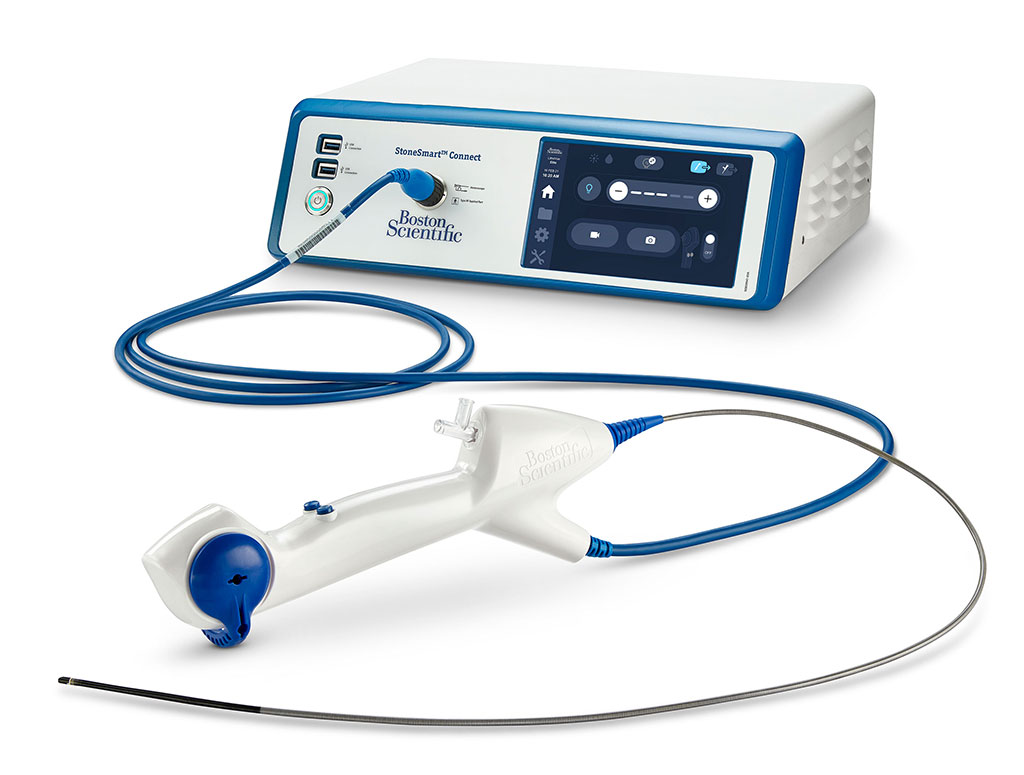 Image: The LithoVue Elite System (Photo courtesy of Boston Scientific)