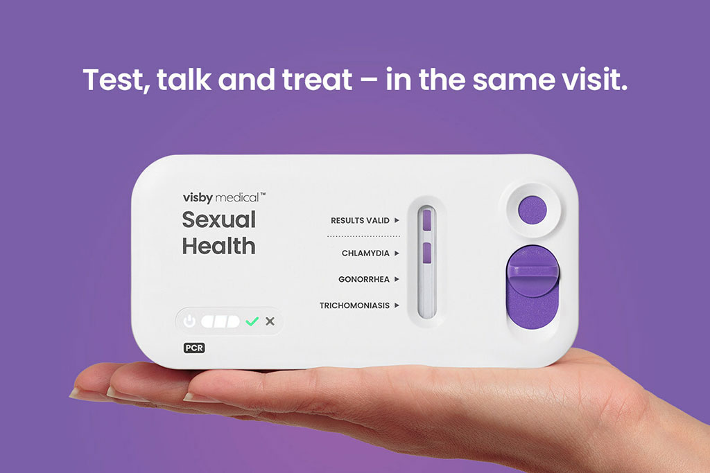 Image: Visby’s second generation Sexual Health Test for women has received FDA clearance and CLIA waiver (Photo courtesy of Visby Medical)
