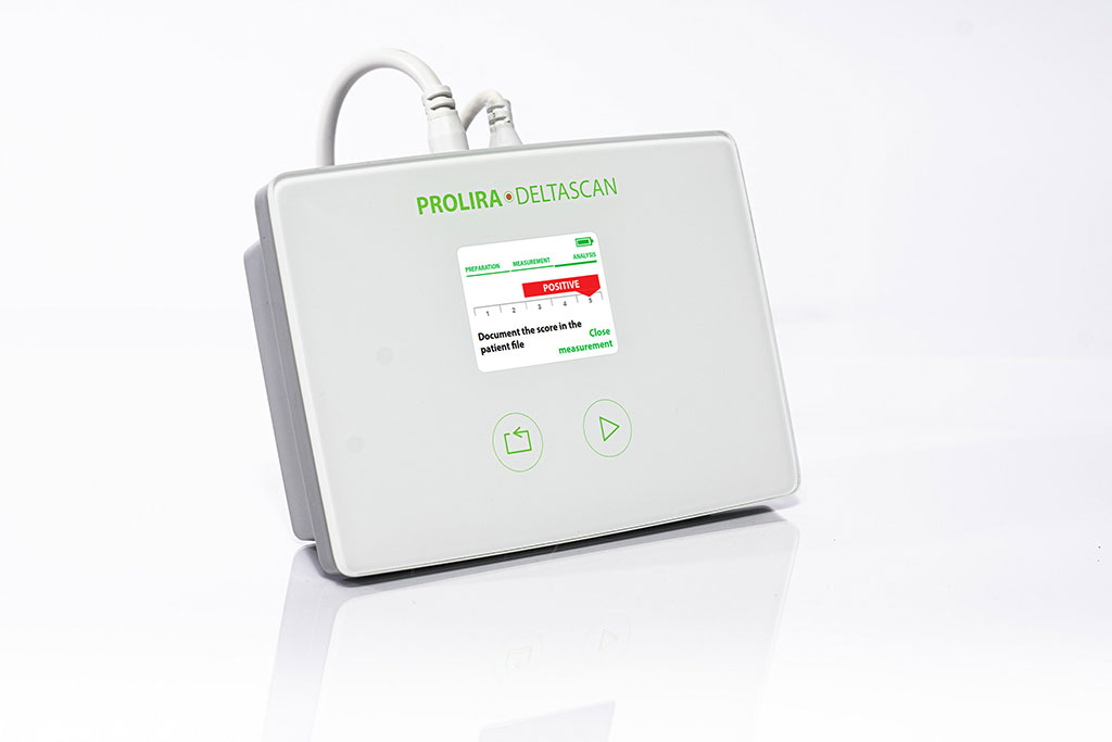 Image: The DeltaScan Brain State Monitor (Photo courtesy of Prolira)