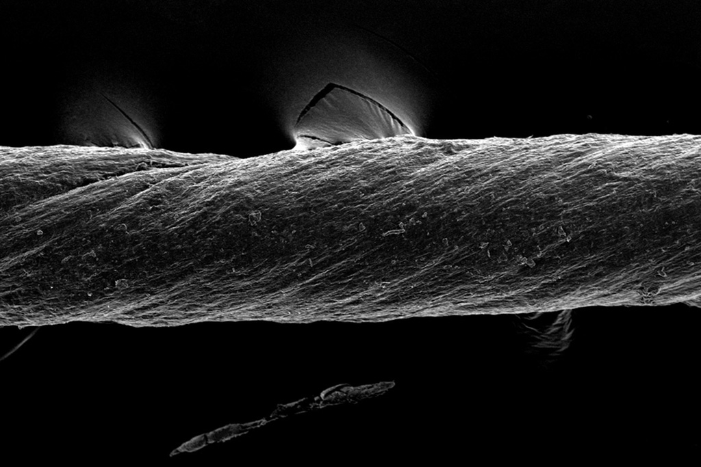 Image: Tissue-derived “smart” sutures can only hold tissue in place, as well as detect inflammation and release drugs (Photo courtesy of MIT)