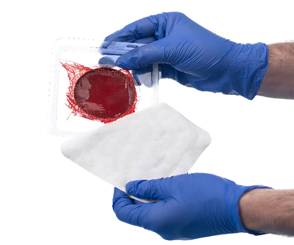 Image: New technology gives patients the power to heal chronic wounds using their own blood (Photo courtesy of RedDress)