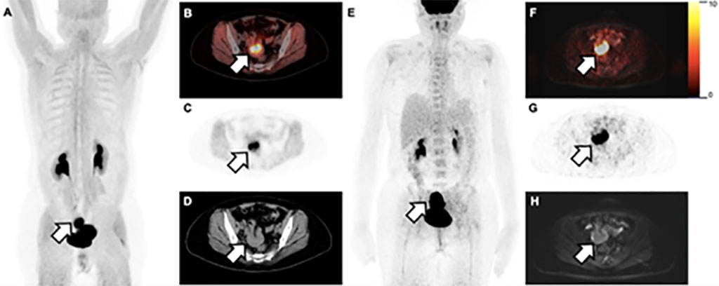 Image: New imaging method offers potential for diagnosing, staging, and treating multiple types of cancer (Photo courtesy of SNMMI)