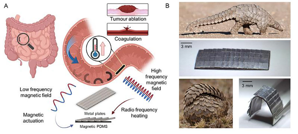 Image: A conceptual illustration of the pangolin-inspired robot operating in the small intestine. (Photo courtesy of Max Planck Institute)