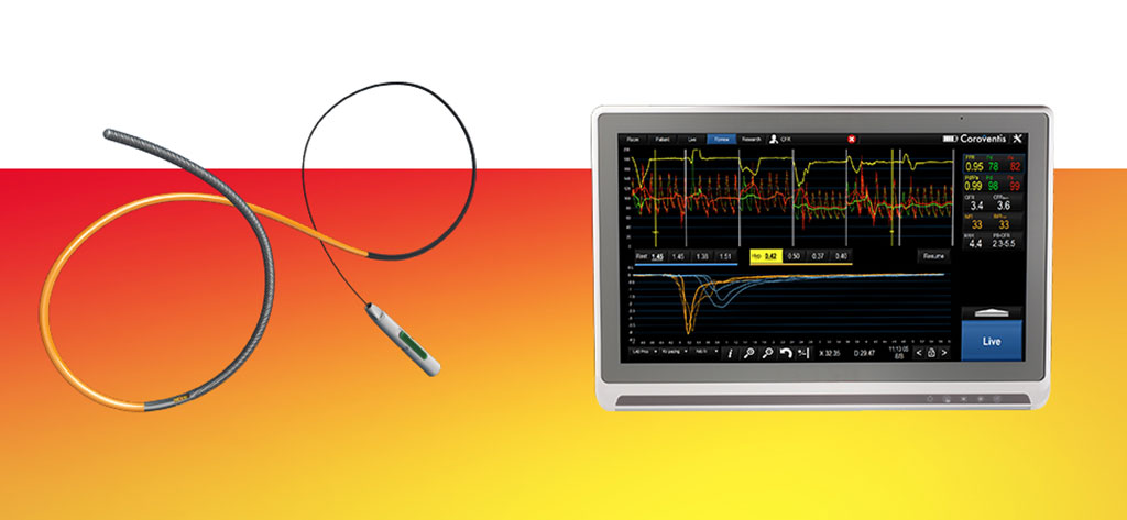 Image: The CoroFlow Cardiovascular System is an advanced platform to measure physiological indices (Photo courtesy of Abbott)