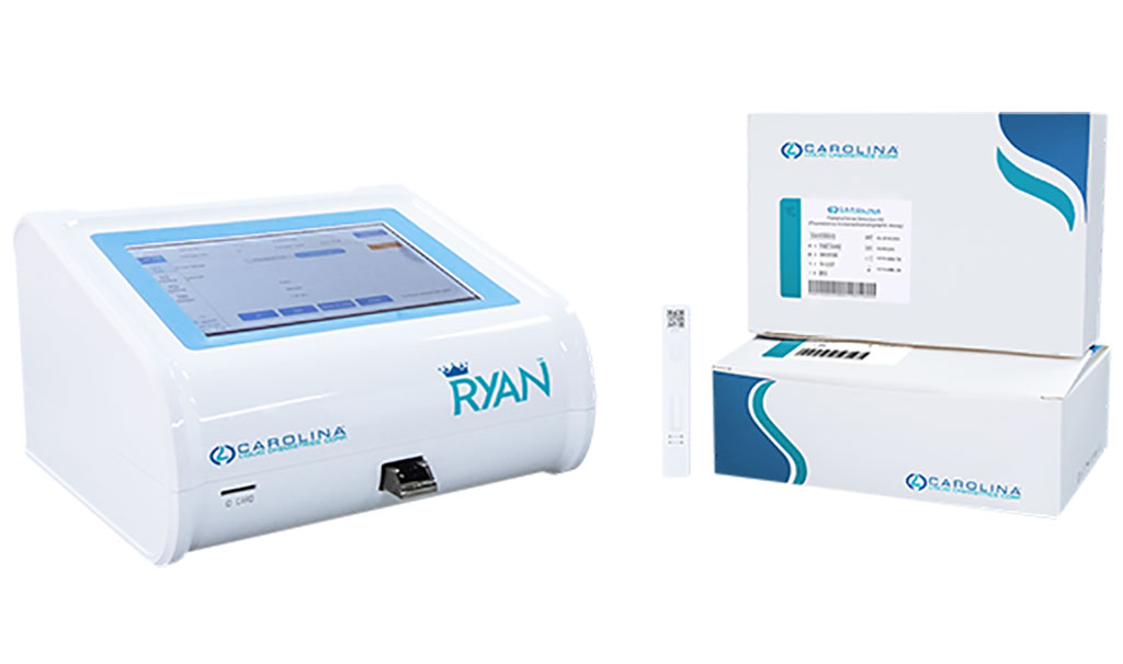 Image: The FDA-cleared POC fentanyl urine detection test runs on the RYAN immunofluorescence analyzer (Photo courtesy of Carolina Liquid Chemistries)