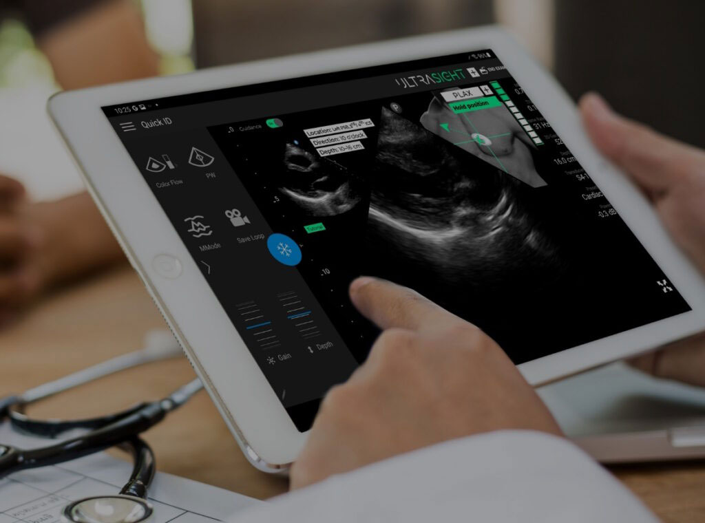 Image: UltraSight`s AI-powered cardiac ultrasound technology has been granted FDA clearance (Photo courtesy of UltraSight) Image: UltraSight`s AI-powered cardiac ultrasound technology has been granted FDA clearance (Photo courtesy of UltraSight)