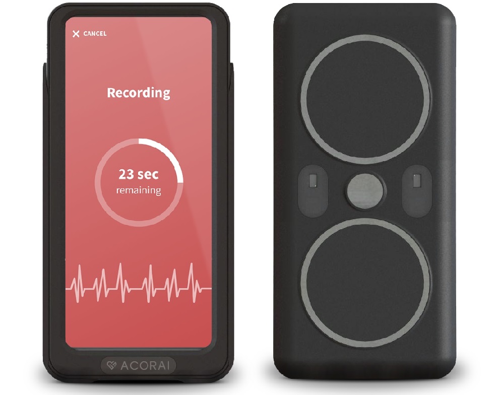 Image: The Acorai Heart Monitor’s hardware platform enables unique sensor insights (Photo courtesy of Acorai)