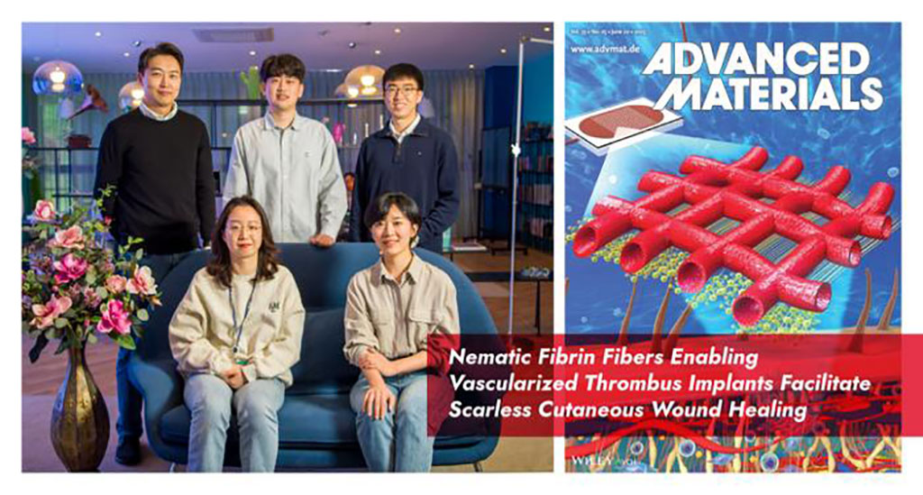 Image: Implantable vascularized engineered thrombi using autologous blood can improve wound healing (Photo courtesy of UNIST)