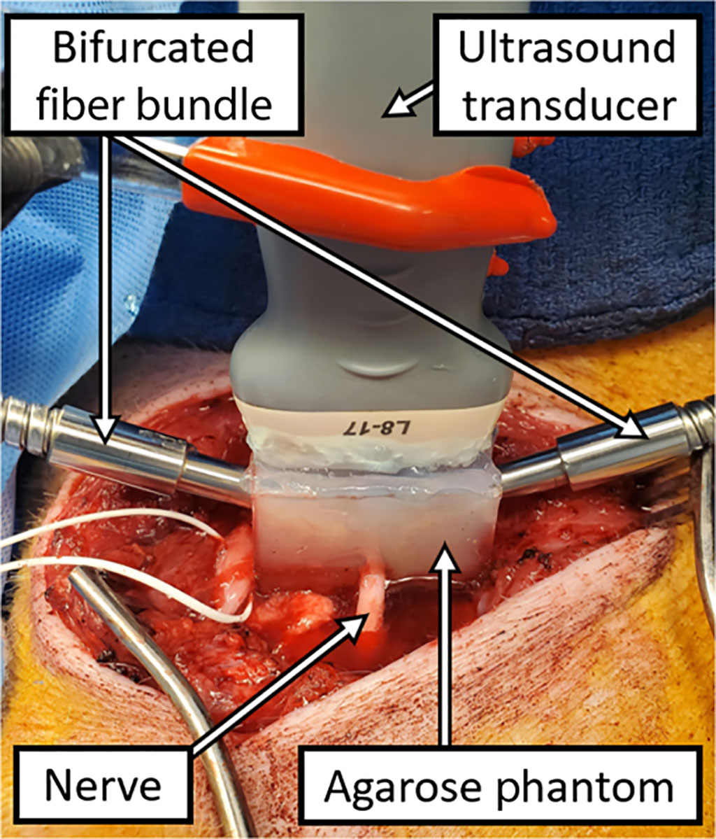 Image: Experimental setup for in vivo photoacoustic imaging (Photo courtesy of SPIE)