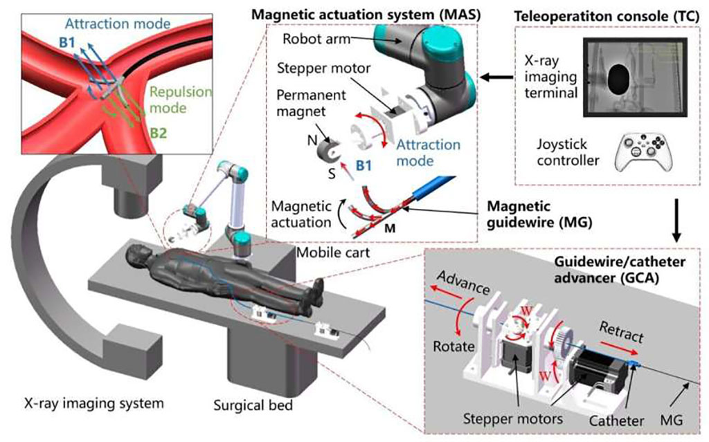 Image: Schematic diagram of interventional surgery and the proposed magnetically controlled guidewire robot system (Photo courtesy of SIAT)