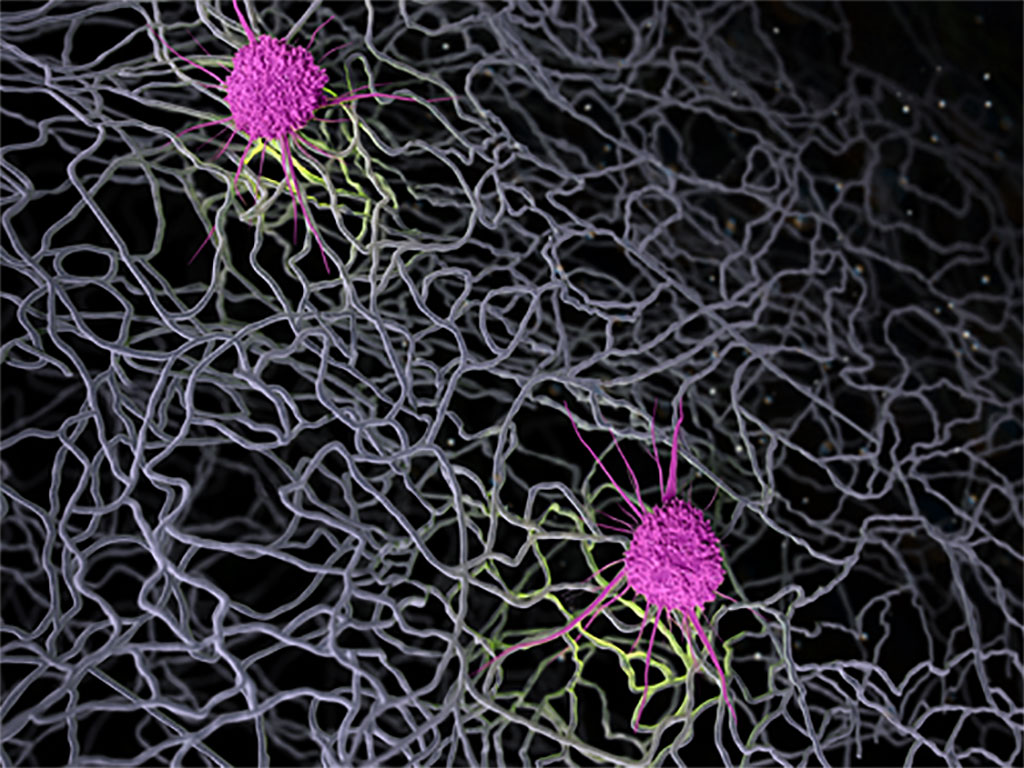 Image: New insight into immune response forges a path toward improved medical implants (Photo courtesy of NIH Medical Arts)