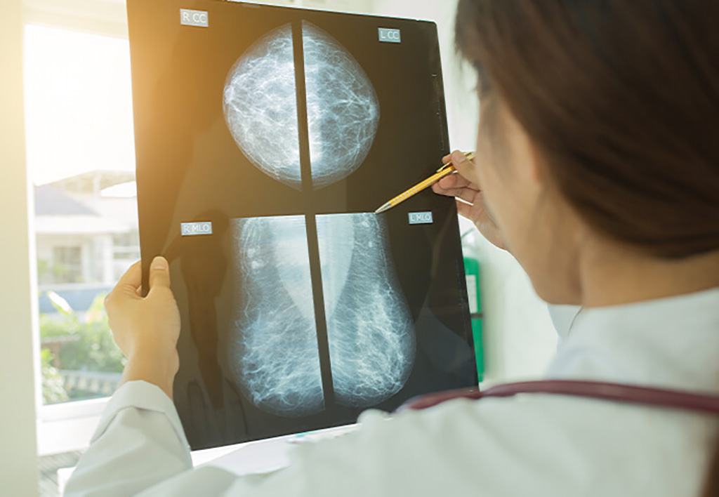 Image: The AI tool, called Mia, could significantly increase early detection of breast cancers (Photo courtesy of Imperial College London)