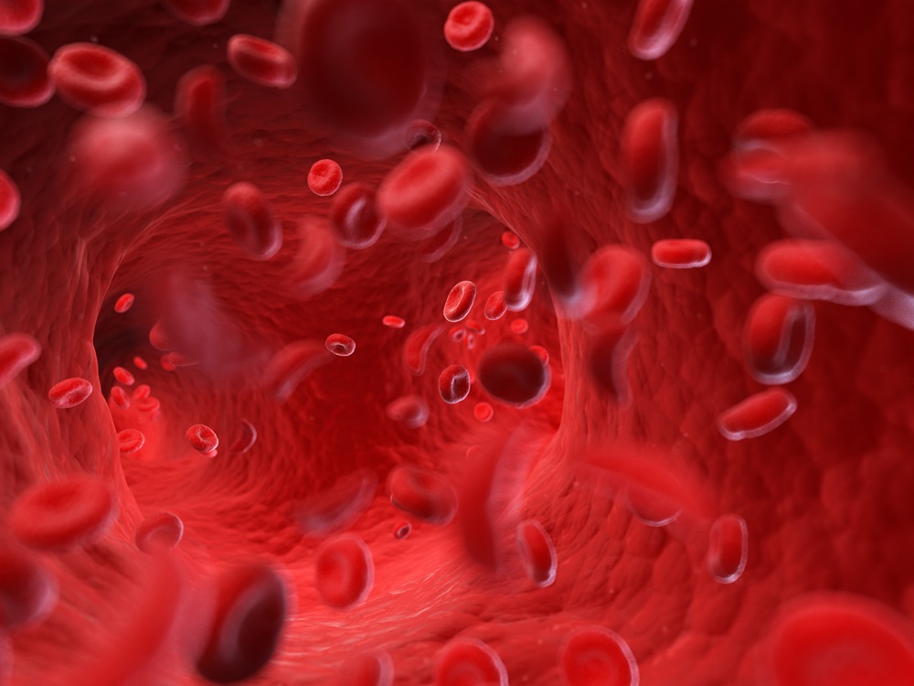 Image: Blood thinners can put patients at risk of life-threatening bleeding during surgery (Photo courtesy of 123RF)