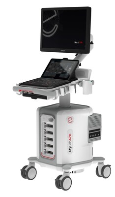 Image: The new MyLabA70 ultrasound system (Photo courtesy of Esaote) Image: The new MyLabA70 ultrasound system (Photo courtesy of Esaote)