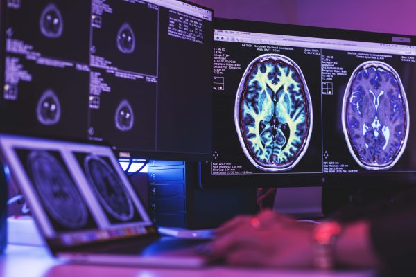 Image: Smart Quant Neuro 3D combines the 3D SyntAc clinical application and SyMRI NEURO 3D (Photo courtesy of SyntheticMR) Image: Smart Quant Neuro 3D combines the 3D SyntAc clinical application and SyMRI NEURO 3D (Photo courtesy of SyntheticMR)