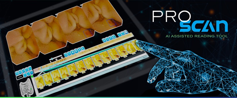 Image: The ProScan AI assisted reading tool is designed to unlock the future of gastroenterology (Photo courtesy of AnX Robotica)