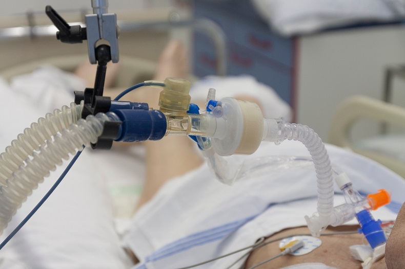 Image: Personalized oxygenation could improve outcomes for patients on ventilators (Photo courtesy of 123RF)