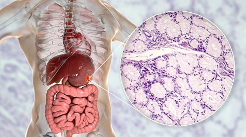 Image: Aptamers could be a promising tool for detecting disease markers, particularly in gastric cancer diagnostics (Photo courtesy of 123RF)